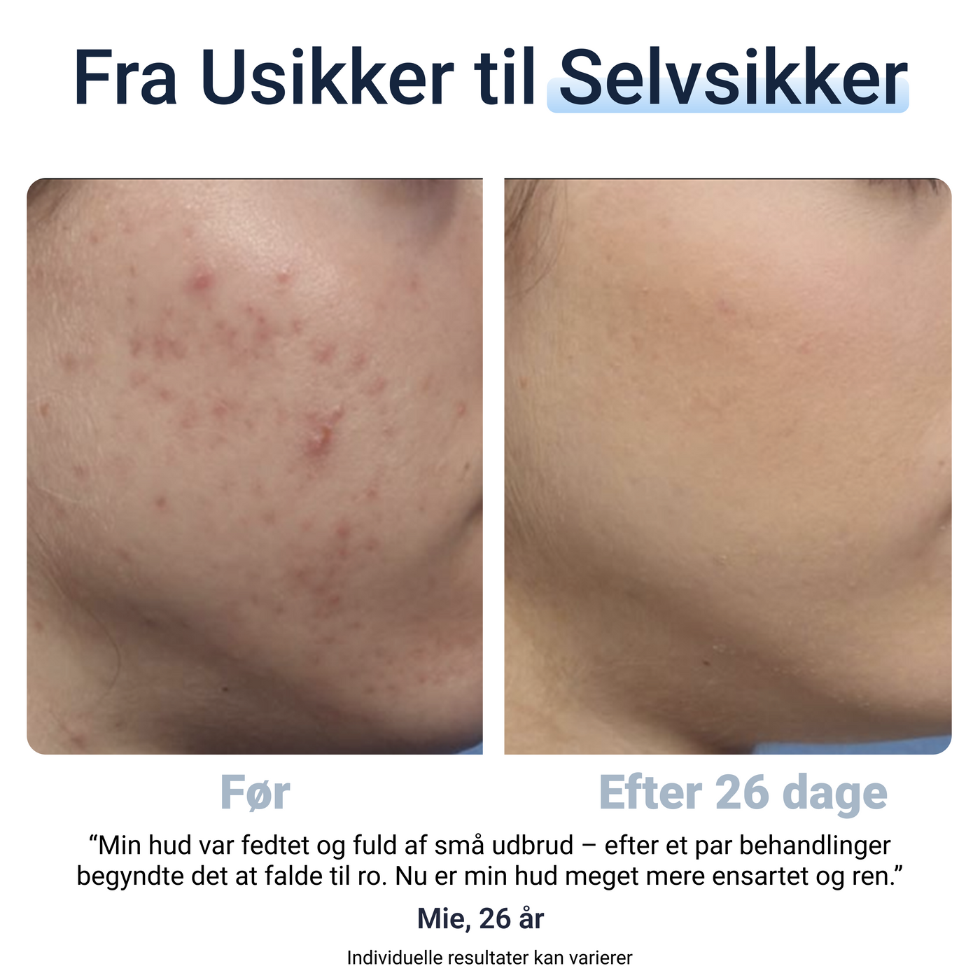 SkinClear™