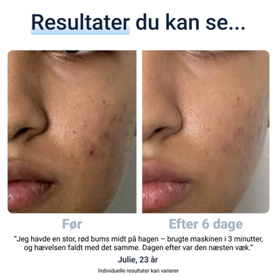SkinClear 1.0™
